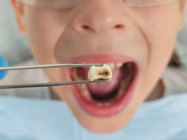Emergency Dentist Open Today in NJ